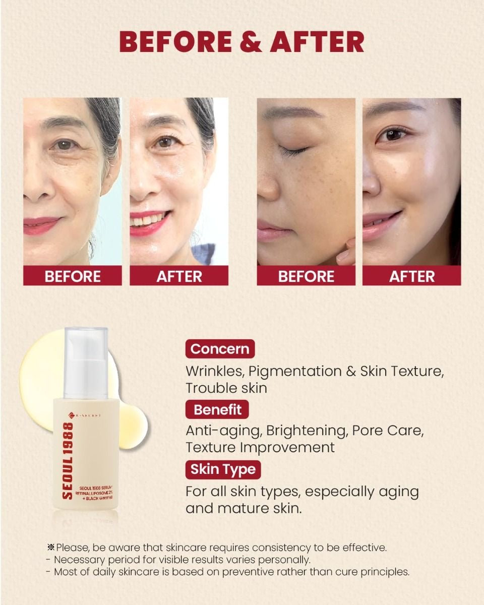 KSECRET - SEOUL 1988 Serum : Retinal Liposome 2% + Black Ginseng